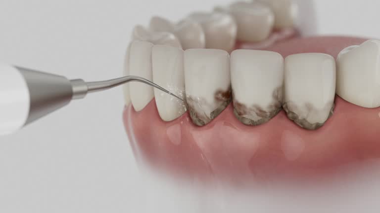 Reliable Dental Implants contractor in Langston, OK by Smile Center Dentistry